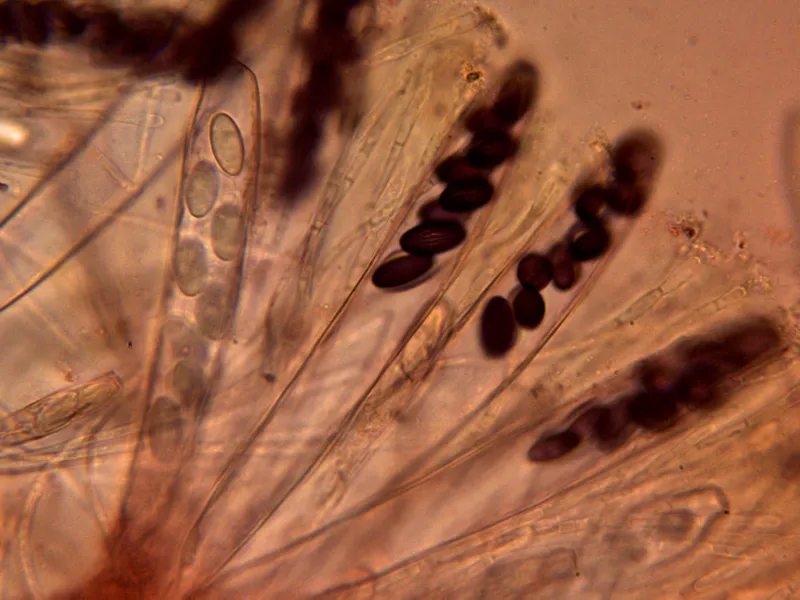 Ascobolus furfuraceus 10 - Ascos x 400